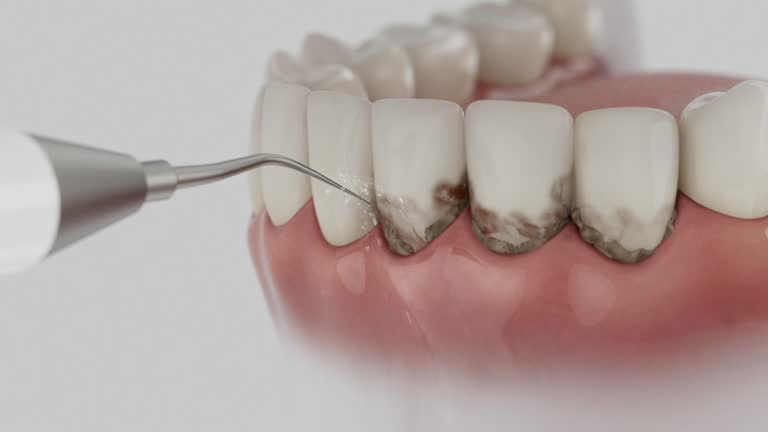 Reliable Tooth Extraction contractor in Crosby, TX by Smile Center Dentistry